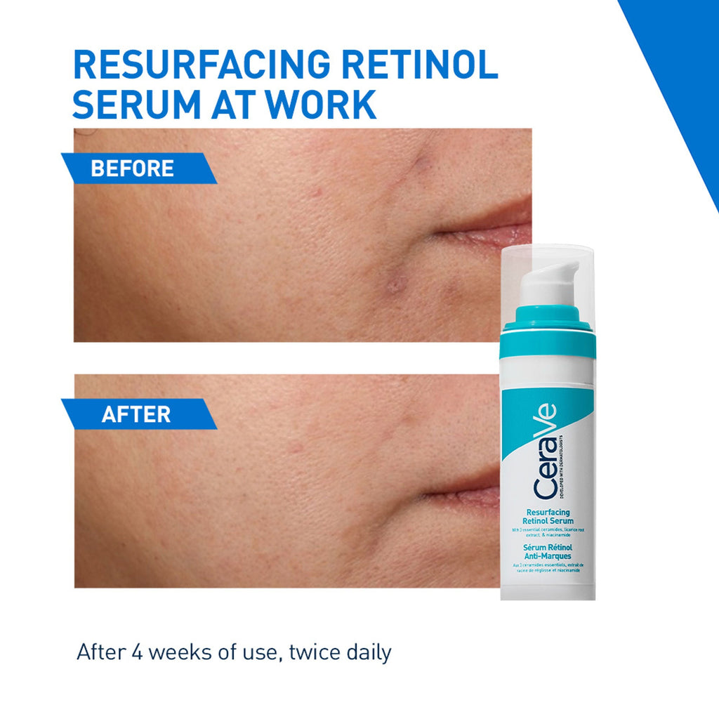 CeraVe Resurfacing Retinol Serum, Reduces Acne Marks with Licorice Root Extract & Niacinamide