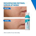 CeraVe Resurfacing Retinol Serum, Reduces Acne Marks with Licorice Root Extract & Niacinamide