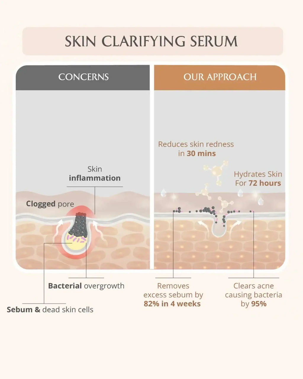 AreoVeda Acne Care Ritual