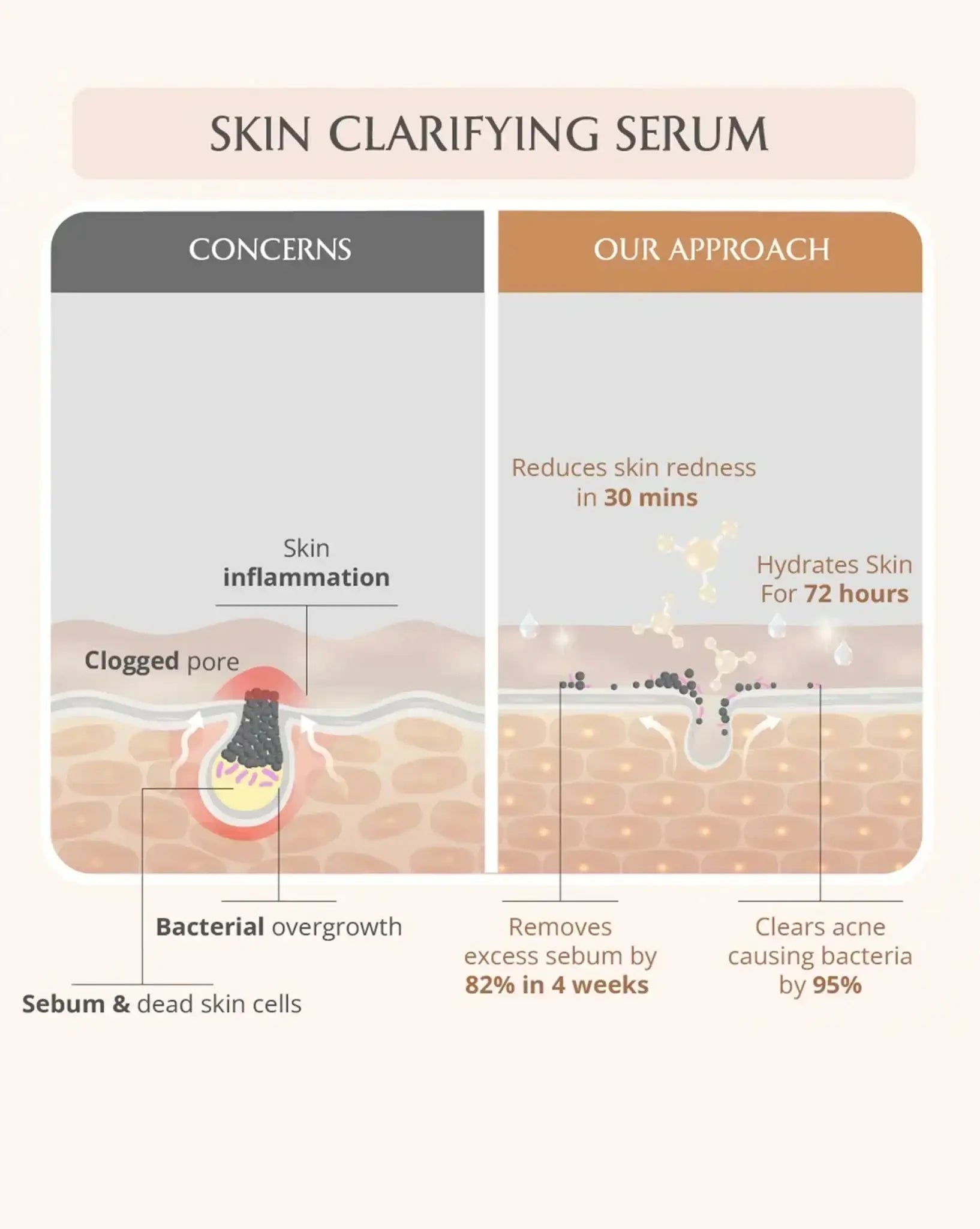 AreoVeda Acne Care Ritual