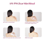 Alite Anti-Acne Soap