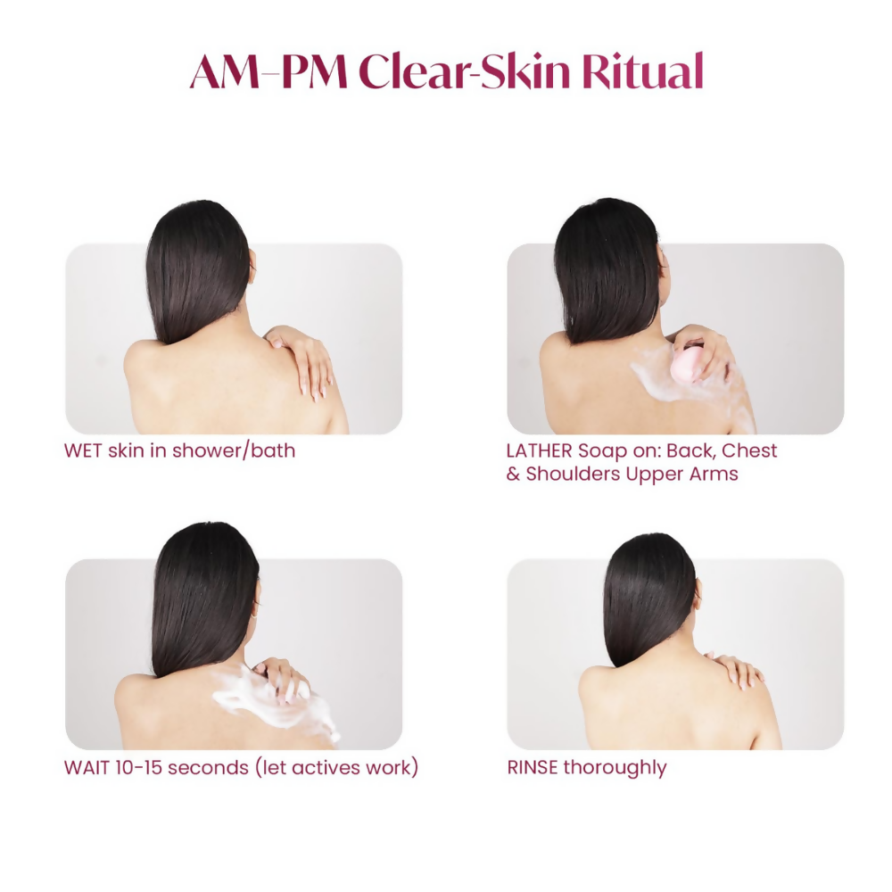 Alite Anti-Acne Soap