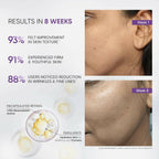 SkinInspired Retinol Night Cream For Wrinkles & Anti-Aging - Distacart