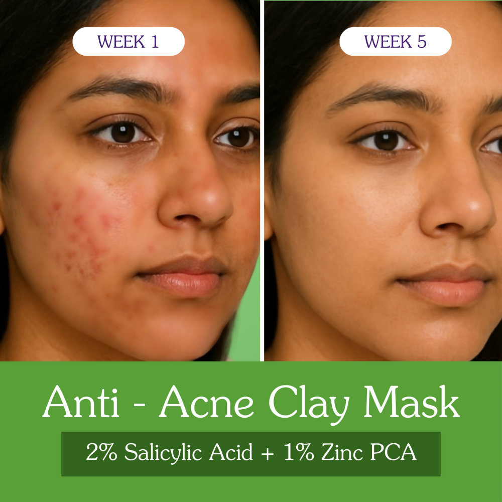 Bake 2% Salicylic Acid + Zinc PCA Anti-Acne Clay Mask