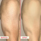 PLIX The Plant Fix Watermelon Hydra-Cool Sunscreen Body Lotion With Spf 50 Pa++++ - Distacart