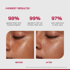 Proven Honest Derma (PHD) 10% Vitamin C Brightening Serum - Distacart