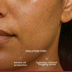 Proven Honest Derma (PHD) 3% Niacinamide Oil-Free Moisturizer - Distacart