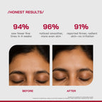 Proven Honest Derma (PHD) 0.3% Retinol Serum With Bakuchiol & Peptides - Distacart
