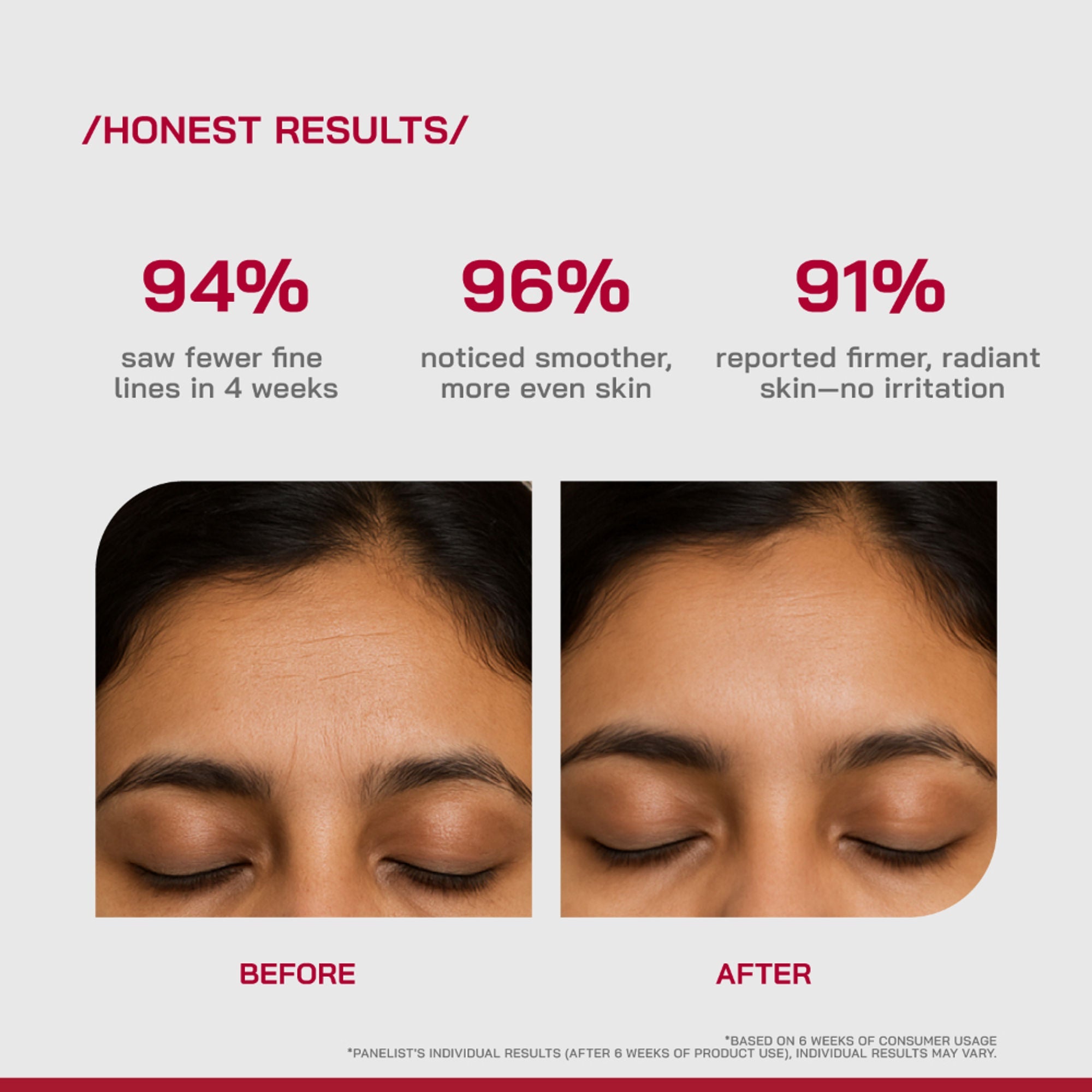 Proven Honest Derma (PHD) 0.3% Retinol Serum With Bakuchiol & Peptides - Distacart