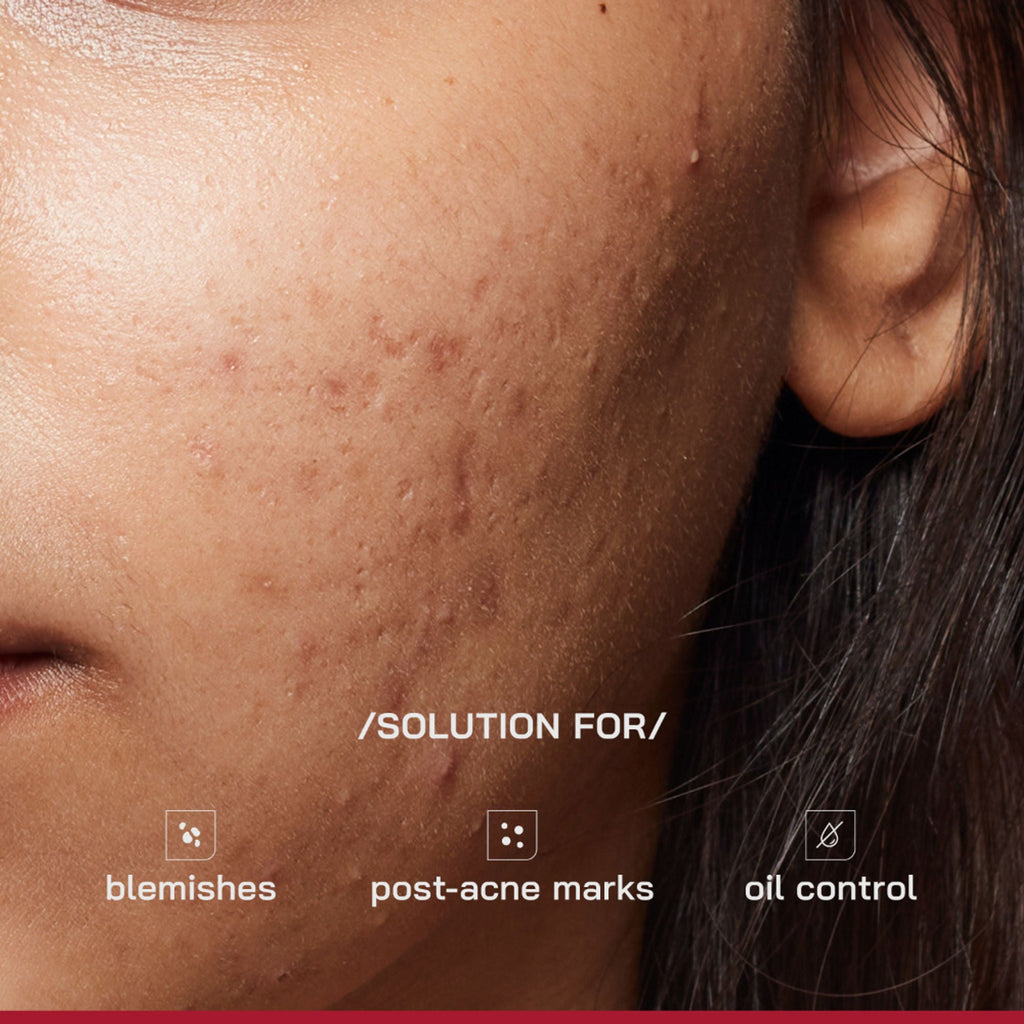Proven Honest Derma (PHD) 10% Niacinamide Spot Correcting Serum - Distacart