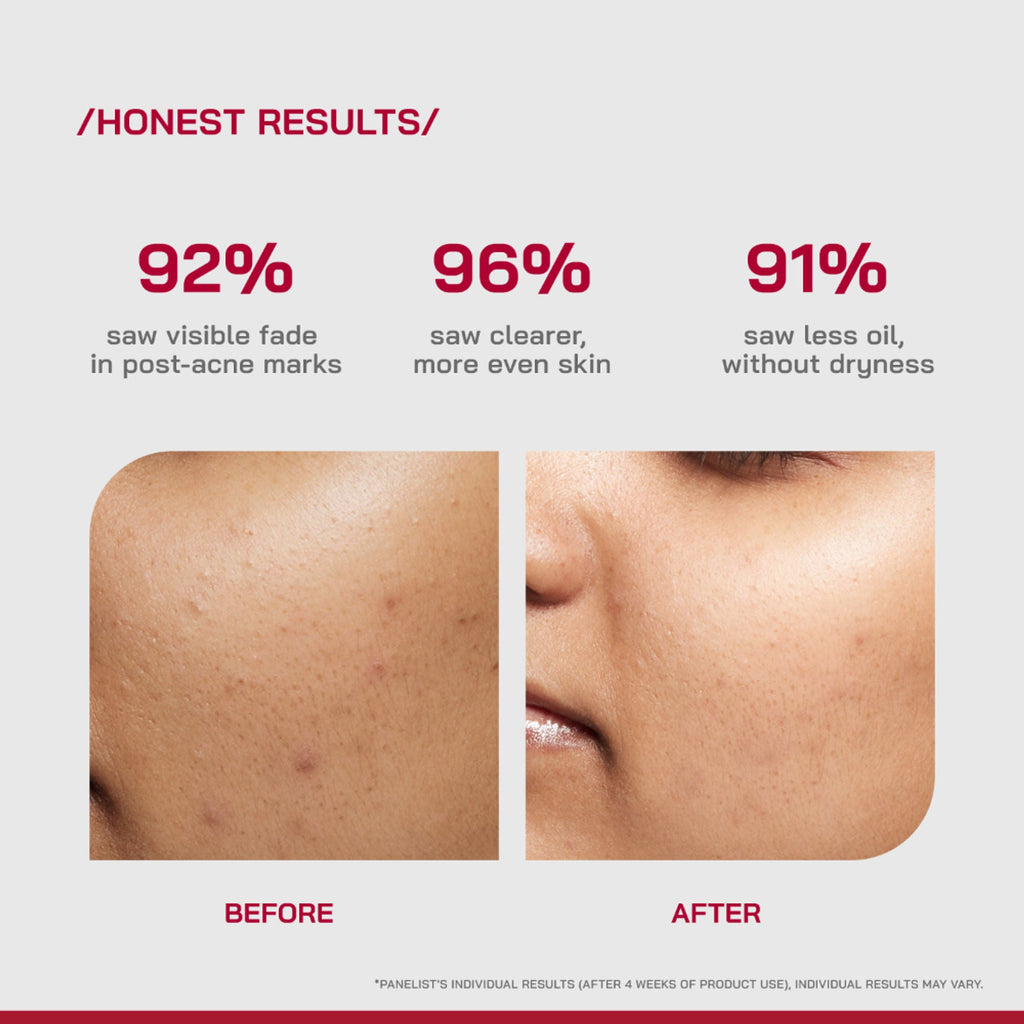 Proven Honest Derma (PHD) 10% Niacinamide Spot Correcting Serum - Distacart