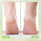 Nykaa Skin Happy Heels 20%Urea, 2%Lactic Acid Foot Cream-Dry & Cracked Feet - Tea Tree & Aloe Vera - Distacart