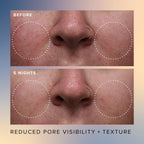 Farmacy Beauty Honey Glow 17% Resurfacing Acid Serum