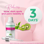 Charmis Anti Acne 2% Salicylic Acid Face Serum with Green Tea & Kiwi Extracts for Clear & Glowing Skin