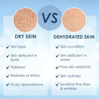 Cetaphil Optimal Hydration Daily Cream, Lightweight, Skin Barrier Protection with Hyaluronic Acid