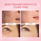 Renee Cosmetics Pink Therapy PDRN Pink Peptide Serum For Radiant Skin, Hydrating, Hyaluronic Acid Infused