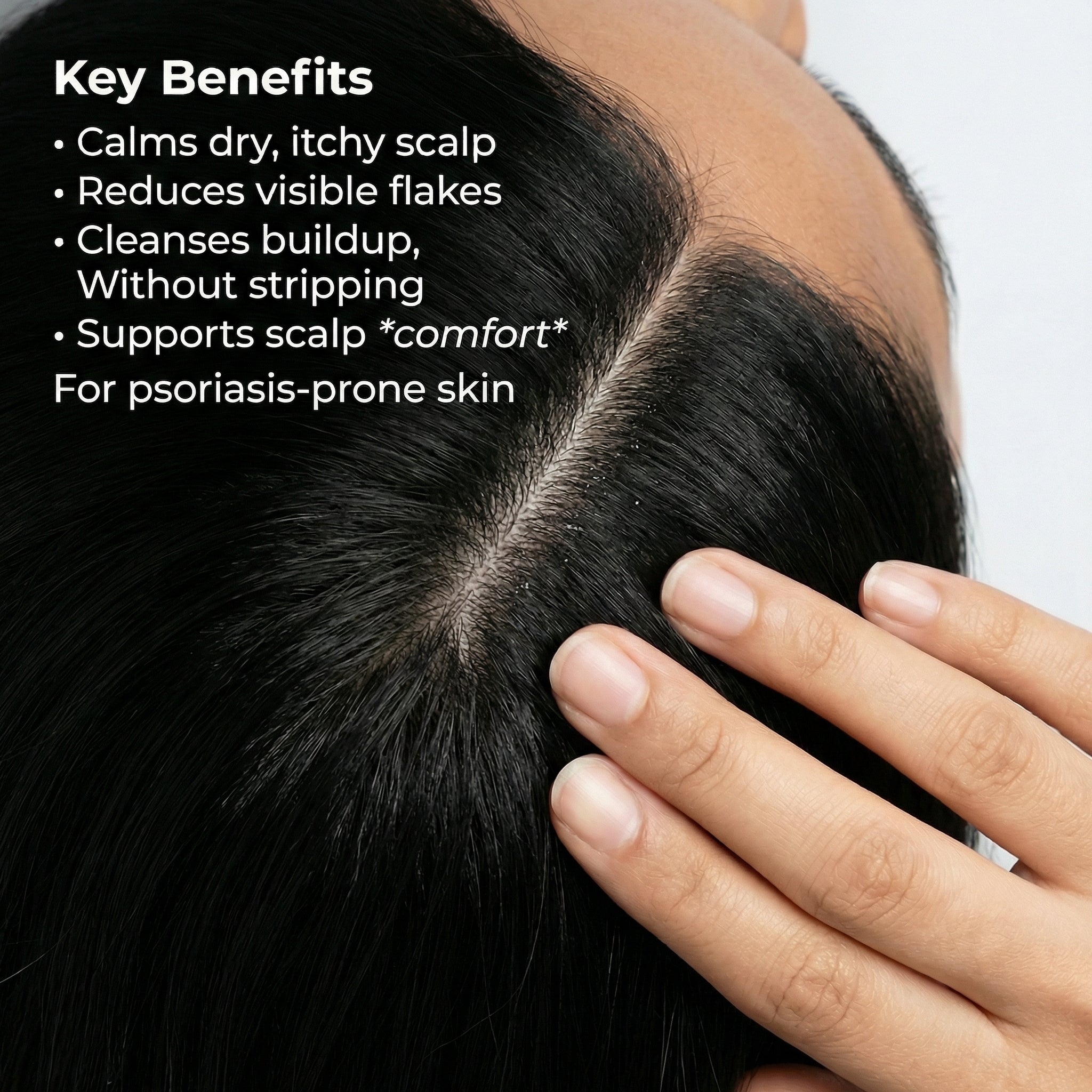 VedicDerm Sensitive Scalp Bundle for Psoriasis, Dandruff, & Itchy Scalp - Distacart