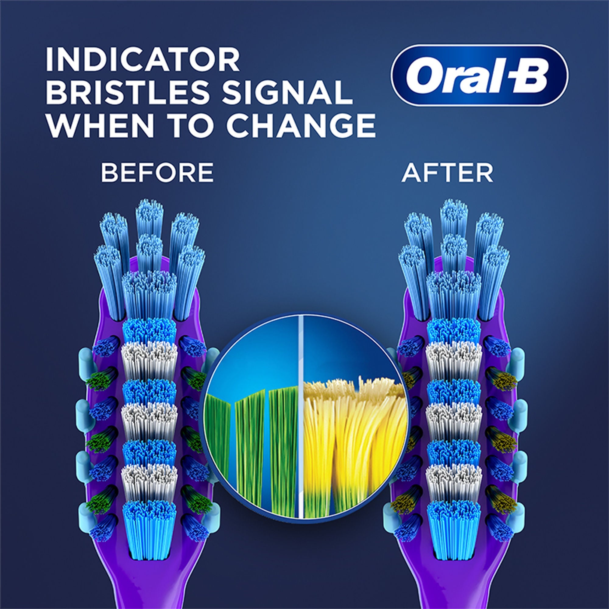 Oral-B Criss Cross Gum Care Toothbrush Buy 2 Get 2 Free (Medium)