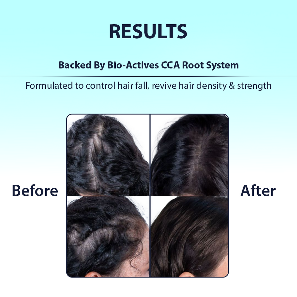 Dermistry Caffeine Collagen Protein Anti-Hair Fall Control Mask