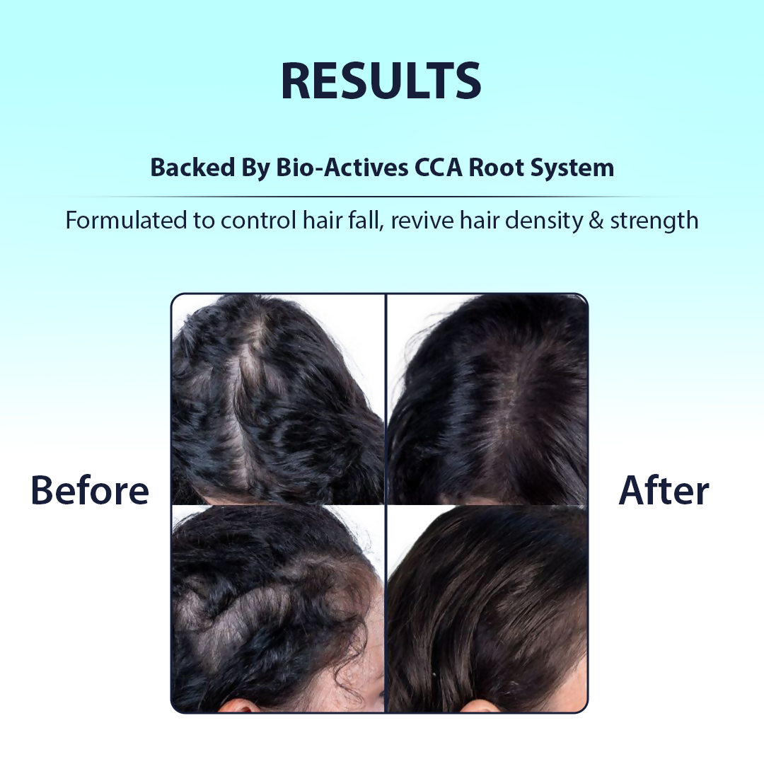Dermistry Caffeine Collagen Protein Anti-Hair Fall Control Mask