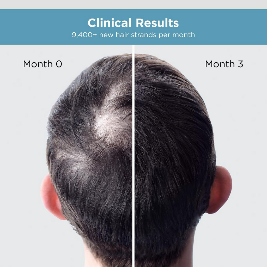 The Man Company Hair Growth Serum For Man - Distacart