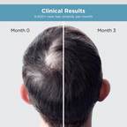 The Man Company Hair Growth Serum For Man - Distacart