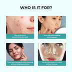 Dr.Sakhiya Acne & Pimple Face Wash