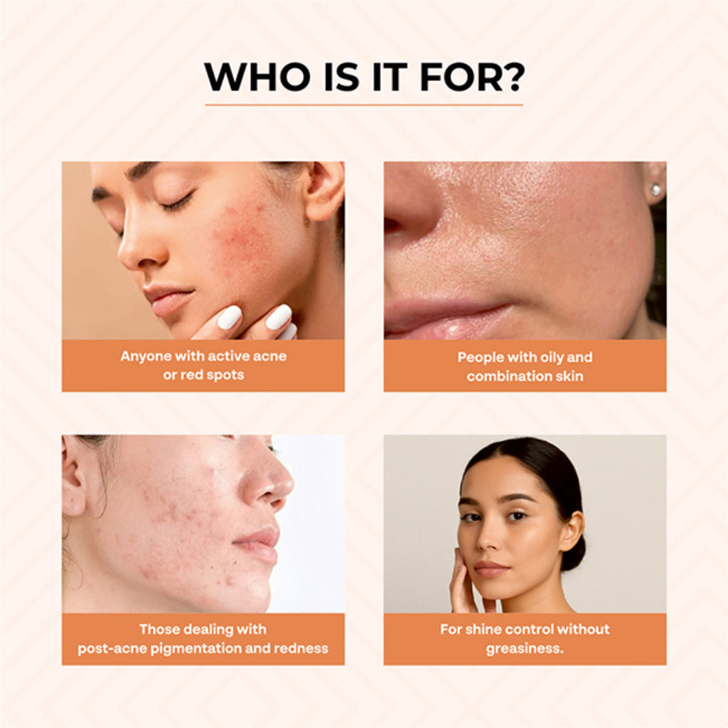 Dr.Sakhiya Acne & Pimple Morning Cream