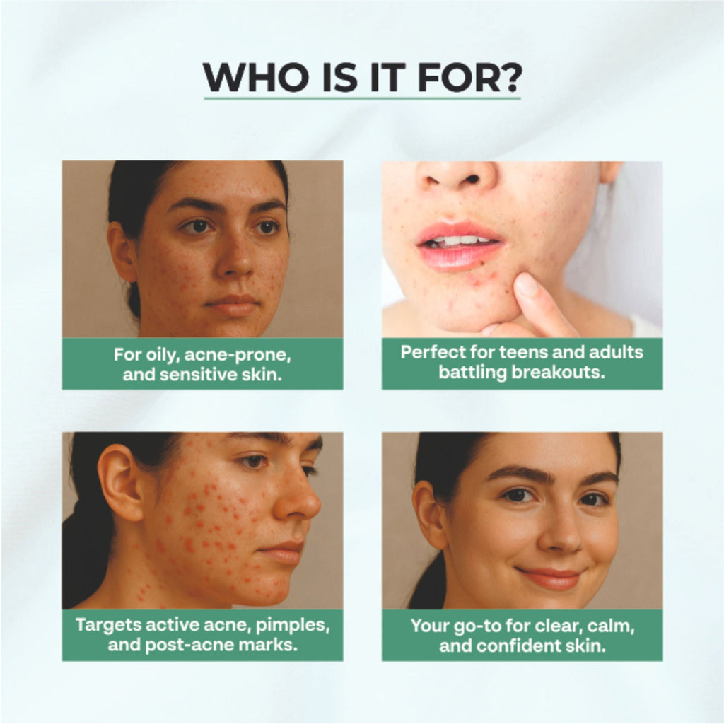 Dr.Sakhiya Acne & Pimple Moisturizer - Distacart