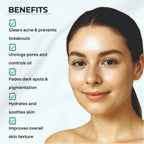 Dr.Sakhiya Acne & Pimple Moisturizer - Distacart
