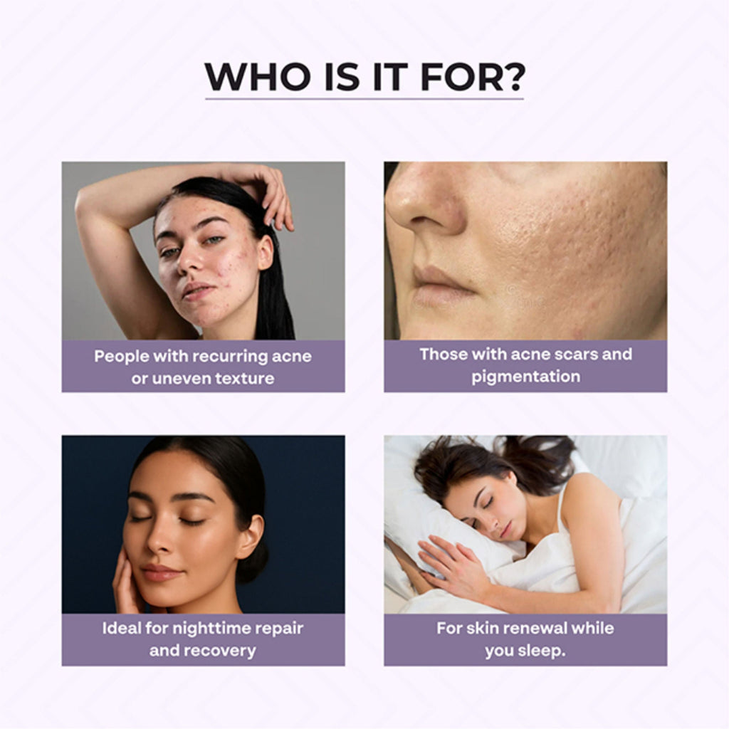 Dr.Sakhiya Acne & Pimple Night Cream