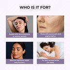 Dr.Sakhiya Acne & Pimple Night Cream