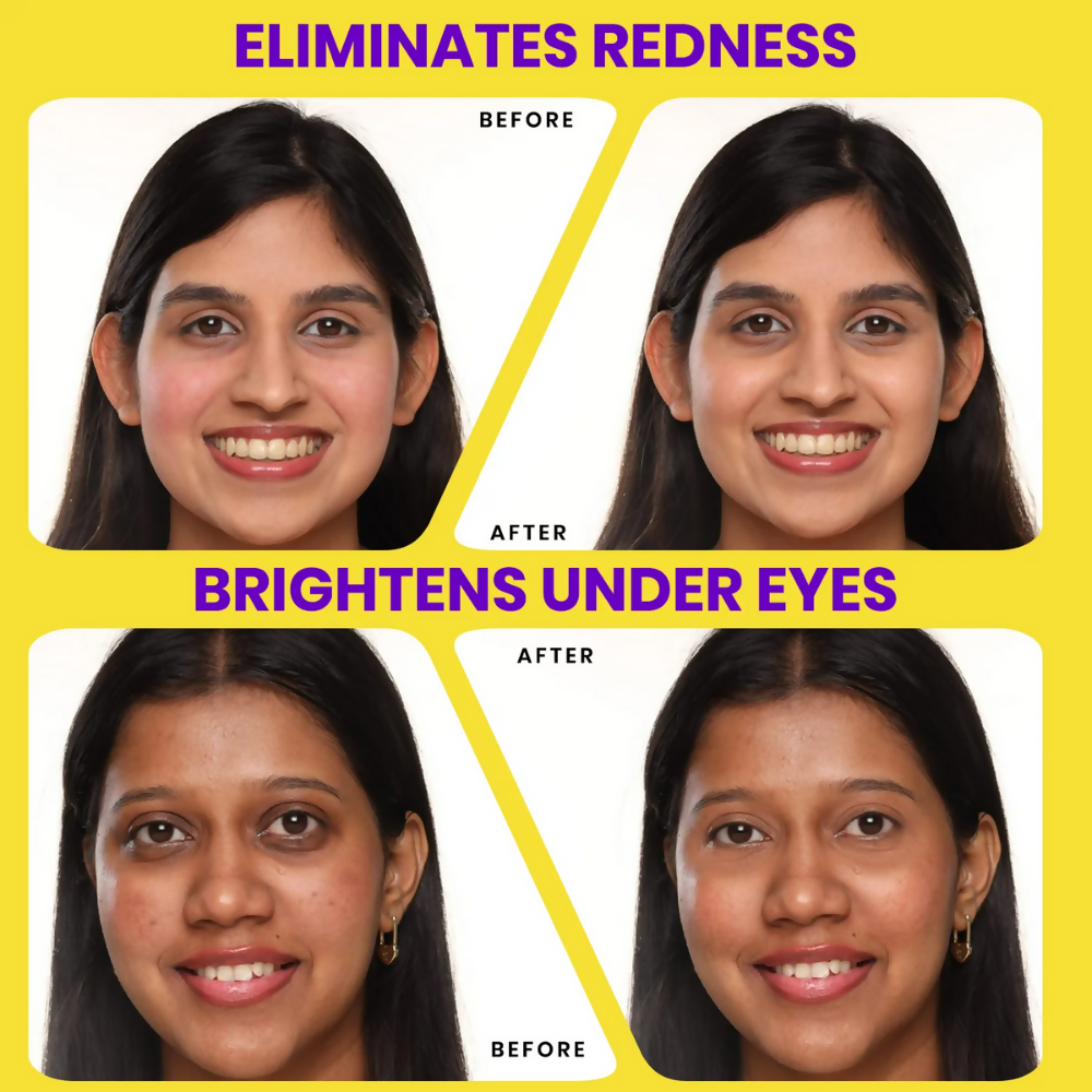 NY Bae HD Spotless Concealer - Golden 04 - Distacart