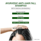 Sesa Ayurvedic Anti-Hair Fall Onion Shampoo