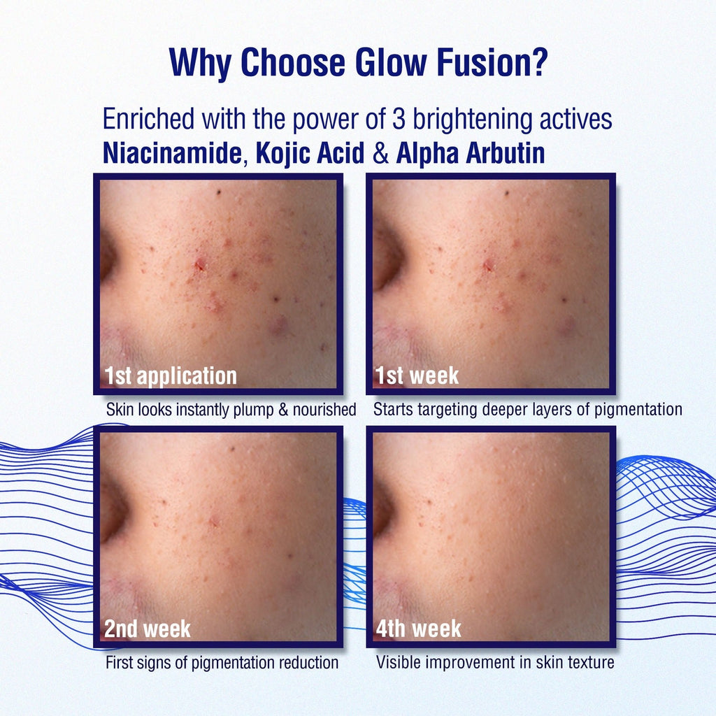 Dermdoc 2% Kojic Acid Night Cream - Distacart