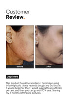 Minimalist Niacinamide 10% Face Serum - Distacart