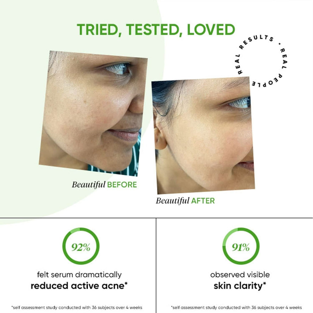 Dot & Key 2% Salicylic + Zinc Acne Busting Face Serum For Acne & Oil Control