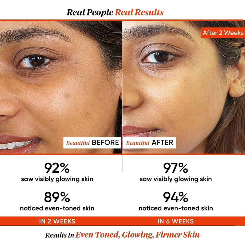 Dot & Key 20% Vitamin C Face Serum with Blood Orange, Skin Glow, Fights Pigmentation & Reduce Dark Spots