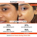 Dot & Key 20% Vitamin C Face Serum with Blood Orange, Skin Glow, Fights Pigmentation & Reduce Dark Spots