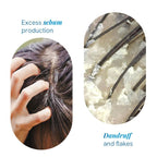 BeBodywise 1% Ketoconazole Dandruff Shampoo For Smooth & Frizz Free Hair