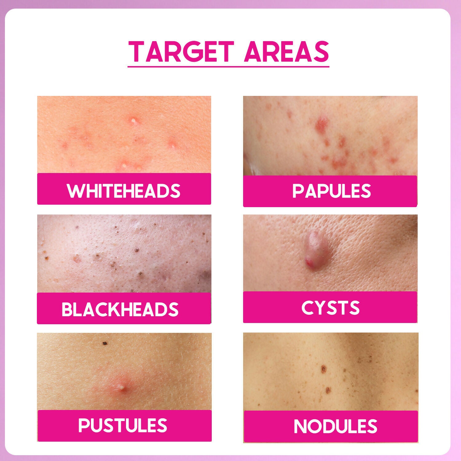 Cos-IQ ABP 11% Beginner Friendly Exfoliating Peel