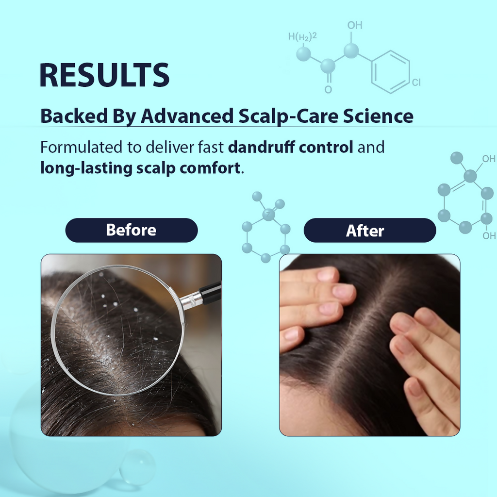 Dermistry Anti-Dandruff Control Shampoo - Distacart