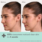 Lotus DermaBotanics Kojic Acid + Multi Berry Ampoule Crème, pH5.5, For Sensitive Skin