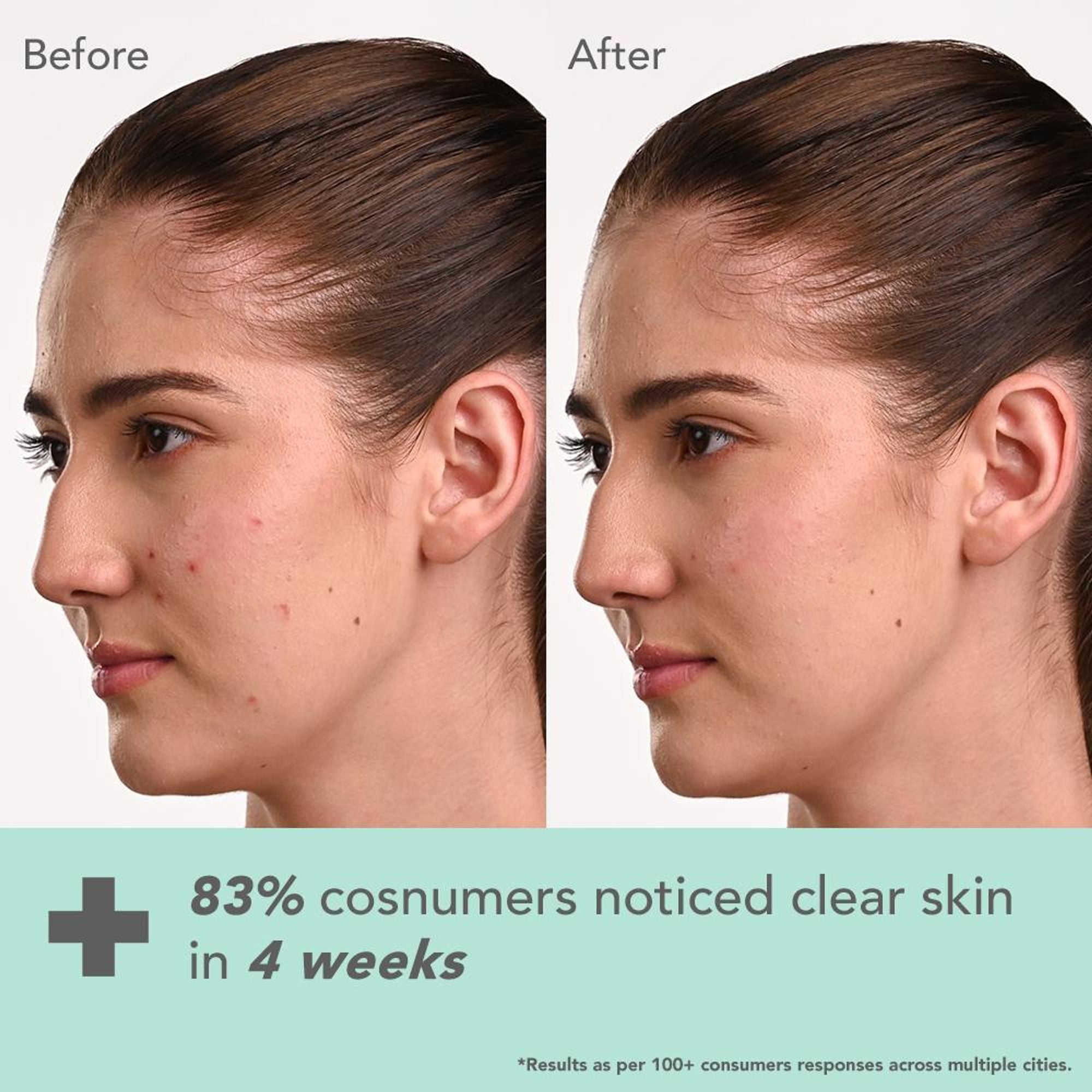 Lotus DermaBotanics Kojic Acid + Multi Berry Ampoule Crème, pH5.5, For Sensitive Skin