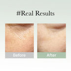 Arencia Holy Hyssop Serum 30 - Brightening Serum for Korean Glass Skin, Reduces Hyperpigmentation