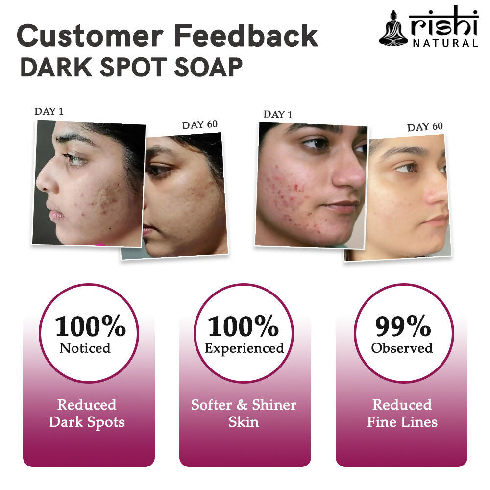Rishi Natural Dark Spot Removal Soap