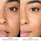 By Terry Hyaluronic Serum Concealer - 4. Rosy Nude