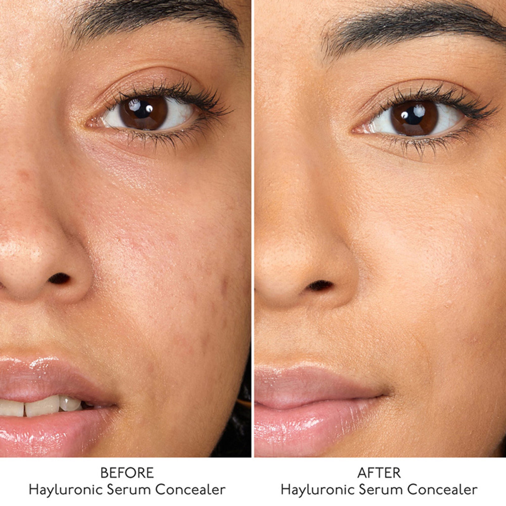 By Terry Hyaluronic Serum Concealer - 4. Rosy Nude