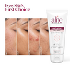 Alite Anti-Acne 5-in-1 Face Wash - Encapsulated Charcoal, Sebum Control Enzyme & Ceramides - Distacart