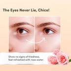 Mylo Care Under Eye Cream with Under Eye Roll-on
